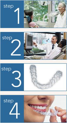 No 1 Cheap Best Invisalign Dubai Clear Aligners Invisible Braces In Uae
