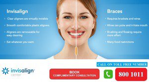best invisalign offer in dubai uae