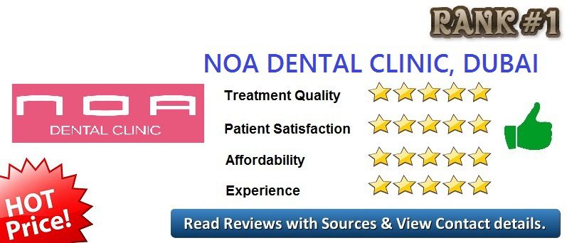 top invisalign στο Ντουμπάι