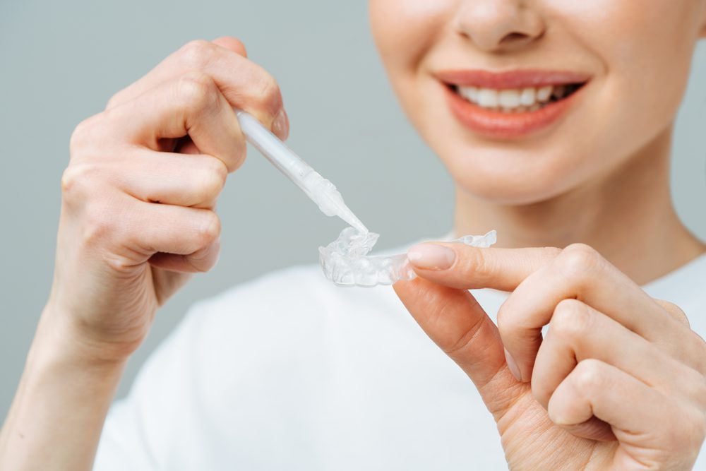 Blanqueamiento dental Dubái