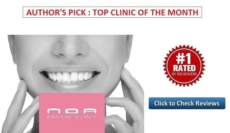 Tooth removal in Dubai