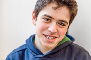 metal braces