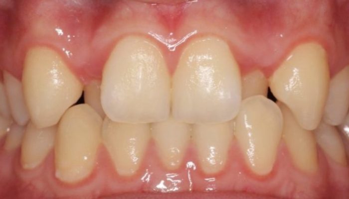 orthodontist dubai