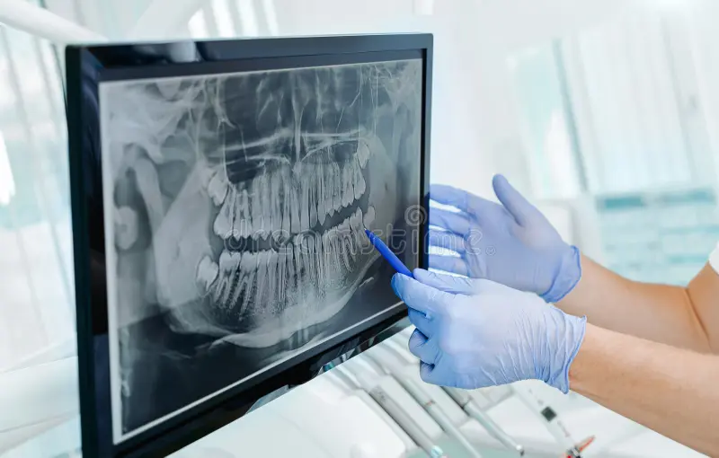 Radiographie dentaire à Dubaï Émirats Arabes Unis